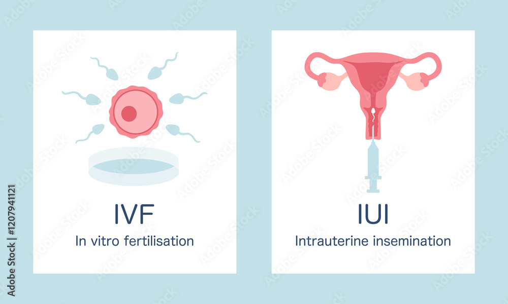 In vitro fertilization IVF and intrauterine insemination IUI ...