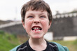 © ADDICTIVE STOCK - Young boy making a fierce face with visible missing tooth in bike day