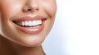 © Skoles - A radiant feminine smile adorned with dazzling veneers that highlight excellent dental health and hygiene. Ideal for dental illustrations, this image represents confidence and beauty in oral care.