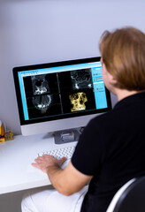Dentist reviewing X-rays. A dental professional analyzes multiple X-ray images on a computer, focusing on patient diagnostics.