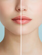 © Bohdan - Comparison of natural and enhanced lips in beauty treatment