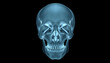 © SusDmi - film x-ray Skull AP : show normal human's skull , with white tonespng