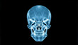 © SusDmi - skull xray scan print on film , with white tonespng