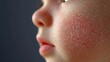 © VirtualVista - Detailed close-up of infant skin displaying a realistic rash, highlighting irritated areas on the face of a baby or toddler.
