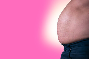 obese man belly fat side view, Cushing's syndrome concept, diabetes concept, man's fat abdomen 