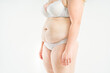 © staras - Tummy tuck, flabby skin with stretch marks on a fat belly, plastic surgery concept on light gray background
