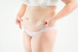 © staras - Tummy tuck, flabby skin with stretch marks on a fat belly, plastic surgery concept on light gray background