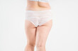 © staras - Overweight thigh, woman with fat hips, buttocks and varicose veins, obesity female body with cellulite on gray background