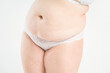 © staras - Tummy tuck, flabby skin with stretch marks on a fat belly, plastic surgery concept on gray background