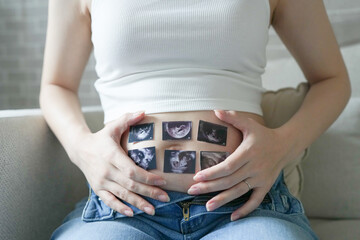 Wall Mural - A Japanese pregnant woman in her 20s, dressed to show her stomach, sits on a sofa in her apartment and has a small echo photo placed on her stomach.