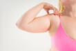 © staras - Sagging flabby skin on a woman's arm, fat and cellulite removal concept