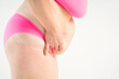 © staras - Tummy tuck, flabby skin with stretch marks on a fat belly, plastic surgery concept on gray background