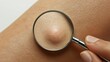 © TensorSpark - Magnifying glass examining skin bump, symbolizing early cancer detection.
