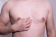 © Alina_Stor - Man scratching red rash on his chest, which could be sign of dermatitis, allergic reaction or skin infection. Skin rashes.