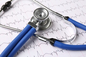 Wall Mural - Cardiology. Stethoscope on paper with cardiogram, closeup