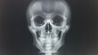 © kept - A detailed X-ray image of a human skull showing clear bone structure.