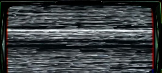 Poster - Glitching oldschool television screens displaying static noise