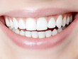 © Lightflow Vision  - tooth bright smile showcasing clean, white teeth and healthy gums