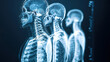 © chekart - Breeding a new kind of people. The concept of human body and personality research. The skeletons of three people are depicted in a blue and white color scheme. An X-ray. The concept of curiosity