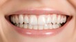 © Angellacelin - Close Up Of A Woman's Bright, Healthy Smile With Even, White Teeth And Pink Lips