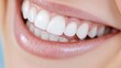 © Generative AI - Close-Up of a Bright White Smile Showcasing Healthy Teeth and Gums : Generative AI