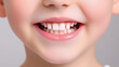 © pattozher - Perfect Smile: A close-up captures the bright, healthy smile of a child. It shows off a set of perfect teeth, radiating health and happiness.