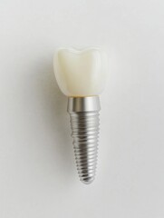 Aufkleber - High quality dental implant showcasing metal texture details on a smooth white background with space for text in the corner Generative AI