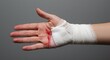 © Jismullah - Injured Hand Wrapped in Bandage