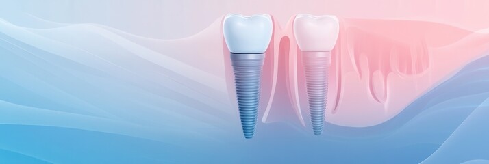 Poster - Illustration of tooth implant cross-section in gum with labeled parts and smooth gradient design on a medical infographic background