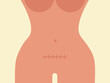 © Xènia Besora Sala/Stocksy - Cartoon female body with scar