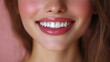 © Sang - Close-up of a smiling woman highlighting white teeth, pink lips, beauty, health, cosmetic enhancement art, captivating.