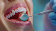 © KhaizanGraphic - Close-up of healthy teeth being examined with a dental mirror.