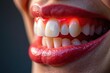 © methinee - Extreme close-up; inflamed gum surrounding affected tooth , gum, redness, background