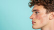 © Ruzana - Acne positivity day concept with side profile of man embracing skin imperfections