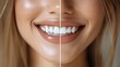 © Sang - Closed eyes, smiling woman's profile shows white teeth, lips, healthy skin, beauty.