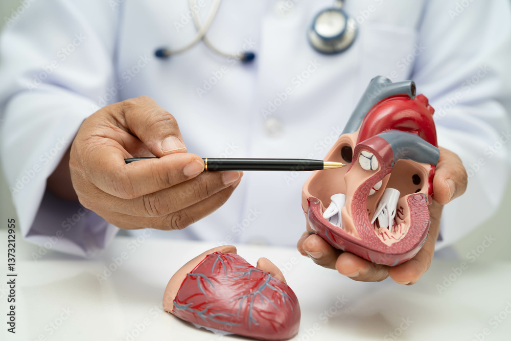 Cardiovascular disease CVD, doctor with heart human model anatomy for ...