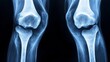 © Ankit - Medical X-ray scan of human knee joints