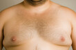 © Axel Bueckert - Overweight male breasts with chest hair and gynecomastia. Man boobs or moobs.