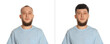 © New Africa - Baldness. Man before and after wearing wig or hair treatment on white background