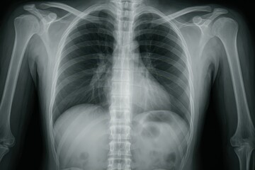 Naklejka na meble Detailed X-ray Image of Human Chest and Rib Cage Structure