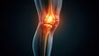 © Rattapoom - Digital rende of a human knee joint showing glowing red area to indicate pain or inflammation set against a dark background for medical illustration