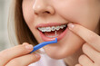 © Pixel-Shot - Young woman with dental braces cleaning teeth at home, closeup
