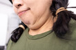 © Tom Wang - fat woman with double chin