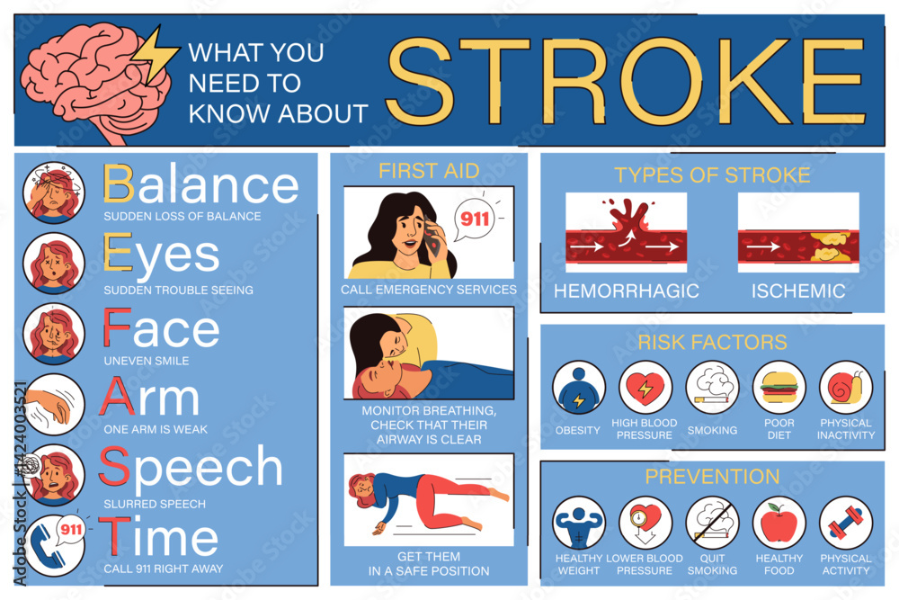 Brain stroke infographics vector isolated. Symptoms, risk factors and ...