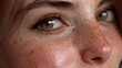 © Dark - Ultra-Realistic Freckles Overlay - High-Resolution Natural Facial Texture Map