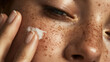 © Mauricio - Woman applying skincare cream for face with freckles beauty routine and healthy skin close up portrait shot