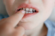 © Elena - Child Pointing at Loose Tooth Close-Up