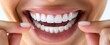 © Georgy - In a close-up, an unidentified black woman is seen pointing at her own healthy white teeth