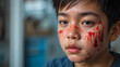 © Michael - Portrait asian boy received Inflamed wound to his face from falling off his bicycle. extensive edema swelling, bruising