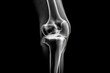 © whitestorm - A detailed X-ray image of a human knee joint, showcasing bone structure and ligaments, isolated on a black background, revealing medical insights.